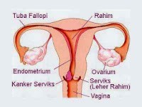 pengobatan tumor Rahim