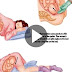 Proper sleeping position during pregnancy you should know!