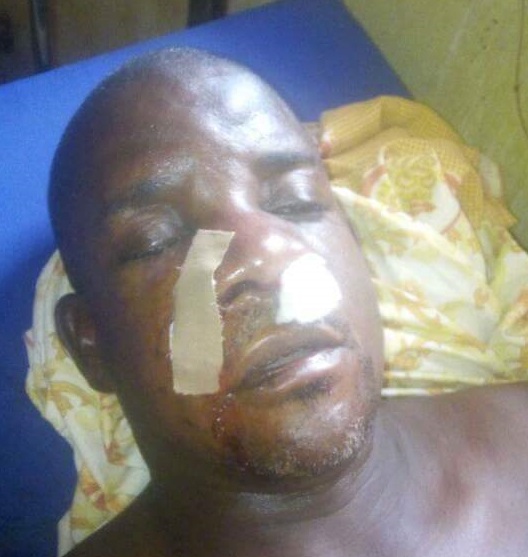 Photos: Suspected Fulani herdsmen attack a Pastor in Taraba State