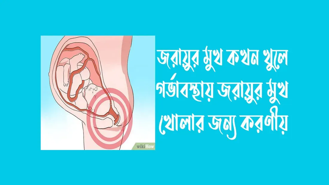 জরায়ুর-মুখ-কখন-খুলে-গর্ভাবস্থায়-জরায়ুর-মুখ-খোলার-জন্য-করণীয়