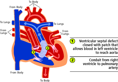 This is how Drew's heart is now!