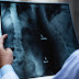 8 little things that hurt my spine that I never thought of