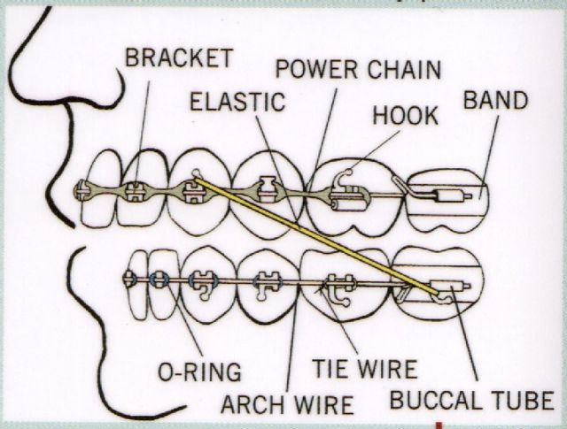 teeth diagram with labels. the teeth move thru the use of