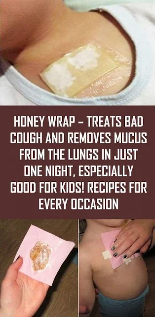 Honey Wraps - Cures Strong Cough and Removes Mucus from the Lungs in Just One Night! Especially Efficient For Children !!!