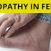 Are You at Risk for Peripheral Neuropathy?