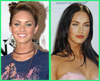 Megan Fox Before Surgery