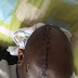 Man Stabbed Severally By HIS OWN Security Guard Makes It Alive! Shares Touching Testimony