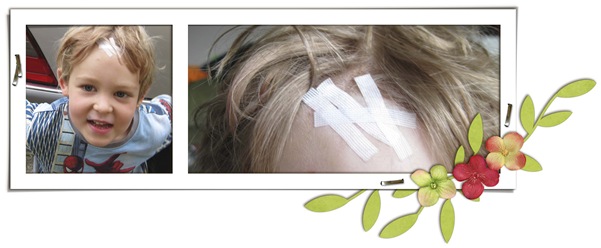 head wound