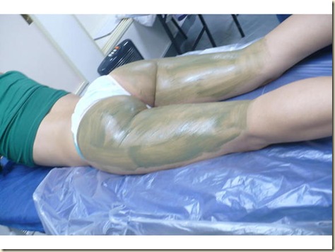 tratamiento de la celulitis3