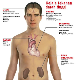 CARA MENGOBATI DARAH TINGGI