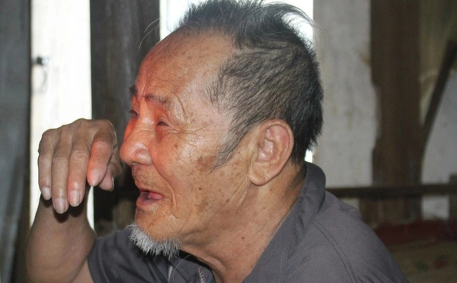 thuong-nguoi-cha-song-canh-mu-loa-van-phai-cham-soc-con-gai-ngo-nghech-6