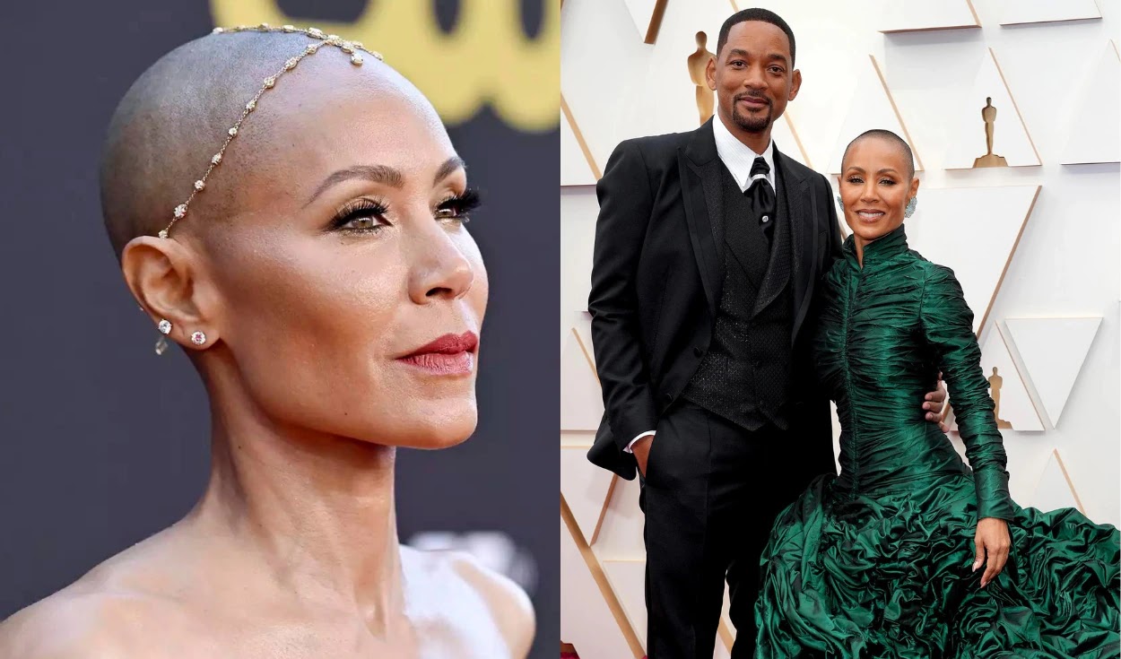 ¿Qué tipo de alopecia padece Jada Pinkett?