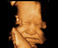 3d Ultrasound Baby3