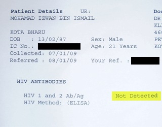 HIV