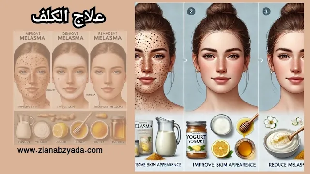 ظهور الكلف