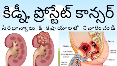 How to Cure Kidney, Prostate Cancer with Siridhanyalu, Kashayalu in Telugu