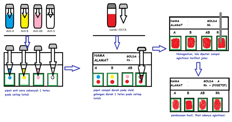 Irens Home Pemeriksaan Golongan Darah Metode Direct Dan