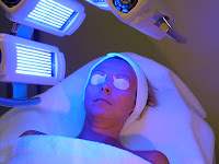 Menghilangkan Jerawat dengan Blue Light Therapy