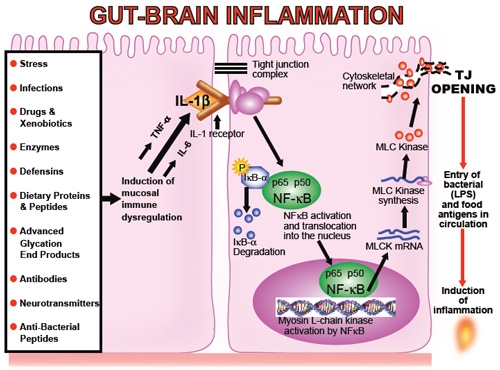 Brain Inflammation5