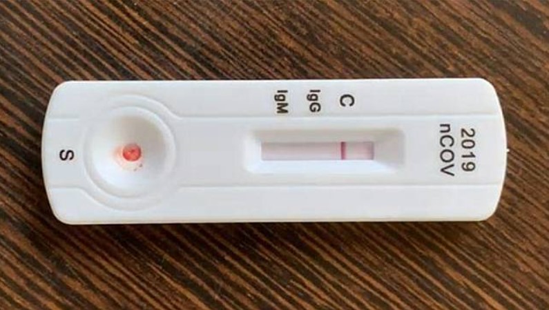 Jangan Salah, Ternyata Rapid Test Tidak Bisa Mendeteksi ...