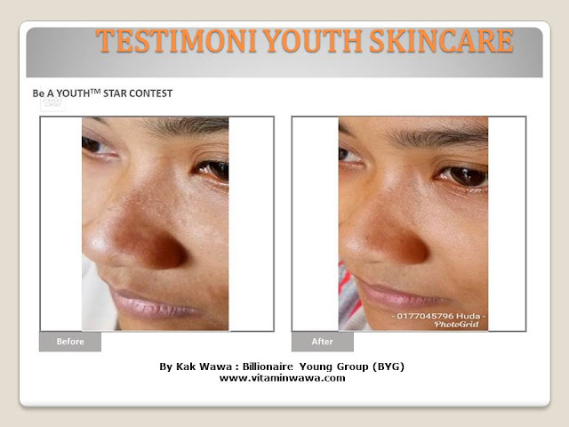 34 Testimoni Youth Skincare Shaklee Terbaru, Youth skincare shaklee, testimoni youth skincare shaklee, Youth Skincare Shaklee : Harga dan Review Pengguna Youth Shaklee, testimoni youth skincare shaklee, testimoni youth skincare shaklee