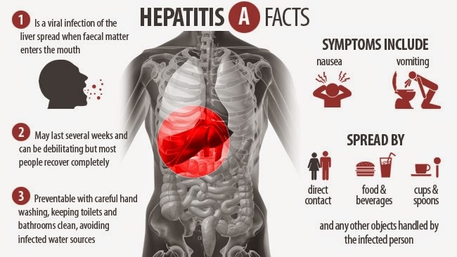  ஹெப்படைட்டிஸ் A, ஹோமியோபதி சிறப்பு சிகிச்சை, Homeopathy Specialty treatment for Hepatitis A at Velachery, Chennai, Tamil Nadu, India 