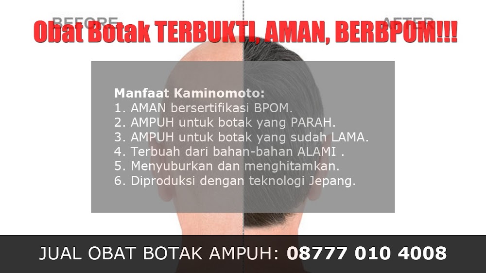 BAGAIMANA CARA MENUMBUHKAN RAMBUT DENGAN CEPAT<br/>Sukamara<br/>