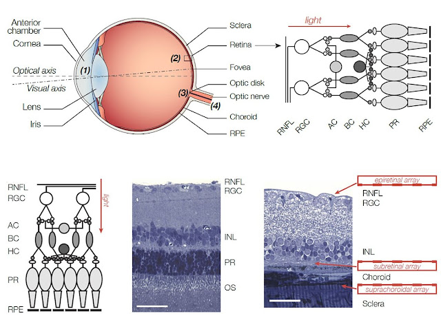 कृत्रिम रेटिना: अनुप्रयोग, सक्षम धारणा और मध्य-इन्फ्रारेड विकिरण की एन्कोडिंग    |    Artificial Retina: Applications, Enabling Perception and Encoding of Mid-Infrared Radiation in hindi