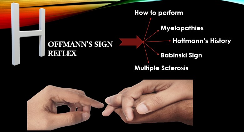Hoffmann S Sign Test Myelopathy Multiple Sclerosis