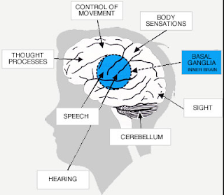 Risk Factors of  Cerebral Palsy 