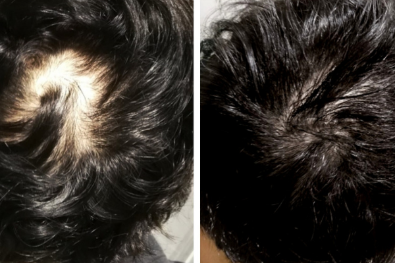 hair growth pills review