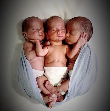 Newborn Triplets Experienced A Special Phenomenon That Amazed Doctors! Read It Here!