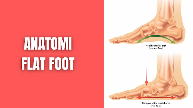 Anatomi Flat Foot Pada Manusia Anatomi Flat Foot Kaki merupakan tumpuan sehari-hari bagi makhluk hidup untuk beraktifitas dalam keseharian, yang menopang seluruh tubuh atau berat badan kita untuk mempertahankan keseimbangan tubuh baik secara statis maupun dinamis, kaki sendiri terbentuk dari susunan tulang, sendi, ligamen serta otot, yang saling melekat satu sama lain. Pentingnya pencegahan deformitas, diagnosis dini, manajemen, yang berkaitan dengan pengetahuan tentang pertumbuhan pada lengkungan kaki sangat berguna, terutama pada masa awal perkembangan aktivitas anak-anak lebih banyak menggunakan kaki yang menopang seluruh anggota tubuh, kalau tubuh sebagai penopang itu tidak kuat tentu saja berakibat tubuh sering jatuh lama kelamaan membuat terjadinya kerusakan bangunan tubuh secara keseluruhan (Ariani, L et all 2009).  Fungsi dan struktur lengkung longitudinal medial dipengaruhi oleh banyak struktur anatomis, pada kaki terdapat tiga lengkung yang yaitu lengkung medial atau lengkung internal terbentuk sepanjang depan ke belakang, tulang-tulang ini saling berkaitan dan berdempetan disatukan oleh ligamen dan didukung oleh otot yang dikaitkan didepan dan belakang tibia. Bagian-bagian lengkung pada kaki: (Ridjal, 2016)    Bagian Lengkung Medial Membentuk tepi medial kaki dari calcaneus merupakan tulang terbesar disebelah belakang dan mengalihkan berat badan ke belakang, talus merupakan titik tertinggi dari telapak kaki bagian sentral dari arkus, navicular & cuneiforme kearah anterior pada 3 metatarsal pertama. Plantar aponeurosis, abduktor hallucis, fleksor digitorum brevis, tibialis anterior, peroneus longus, tibialis posterior, dan fleksor hallucis, ligamen spring yang berfungsi membuat elastisitas bagian-bagian tersebut yang mensuport arkus medial.    Lengkungan Lateral Lengkungan lateral dari calcaneus berjalan melalui cuboideum kearah anterior melewati metatarsal IV danV. Secara normal arkus ini menyentuh bagian tanah/ lantai didukung oleh ligamen plantar, plantar aponeurosis, fleksor digitorum brevis, fleksor digitiminimi, abduktor digitiminimi, peroneus tertius, peroneus brevis, dan peroneus longus.    Lengkugan Transversal Transversal dibentuk arkus ini tidak memanjang seperti arkus longitudinal oleh basis oss metatarsal berjalan dari melalui 3 cuneiforme ke oss cuboideum, cuneiforme II merupakan keystone arkus ini.    kelainan atau gangguan yang dapat menyebabkan hambatan berjalan adalah flat, keadaan ini disebabkan oleh adanya kelemahan struktur yang menyokong arkus longitudinal pedis. Pada kondisi flat foot dimana terjadi kelainan atau keterlambatan, bentuk telapak kaki manusia terbagi menjadi tiga jenis yaitu normal foot, flat foot dan cavus foot sesuai struktur lengkungan pada telapak kaki.    Nah itu dia bahasan dari anatomi flat foot pada manusia pada manusia, melalui bahasan di atas bisa diketahui mengenai anatomi flat foot pada manusia pada manusia. Mungkin hanya itu yang bisa disampaikan di dalam artikel ini, mohon maaf bila terjadi kesalahan di dalam penulisan, dan terimakasih telah membaca artikel ini."God Bless and Protect Us"