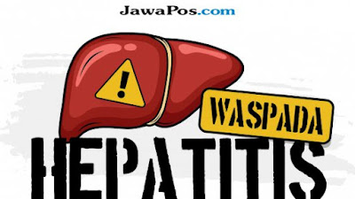 72 Persen Penderita Hepatitis Akut Alami Demam