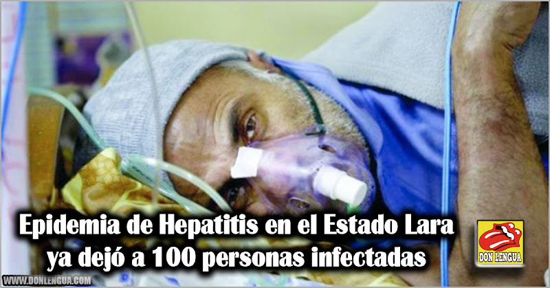 Epidemia de Hepatitis en el Estado Lara ya tiene a 100 personas infectadas