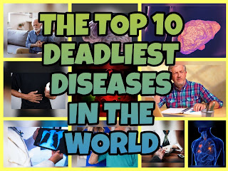 The Top 10 Deadliest Diseases in the World | TOP 10 REAL