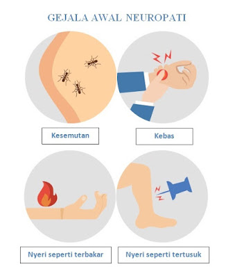 Terlalu Sering Menggunakan Laptop dan Gadget, Waspada Neuropati