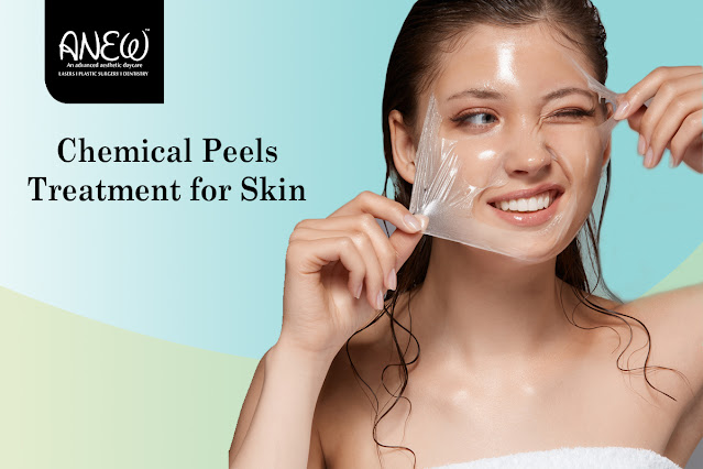 chemical peel in bangalore