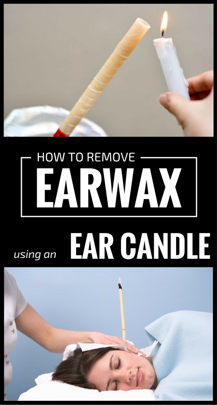 How To Remove Earwax Using An Ear Candle xavidream