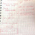 Intégral de Ln(x) 