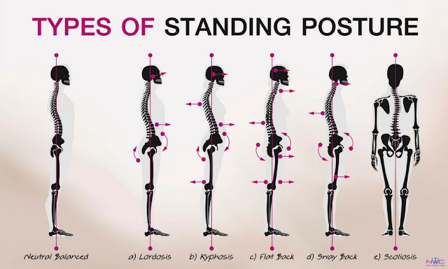 Correct imbalance using Zhan Zhuang