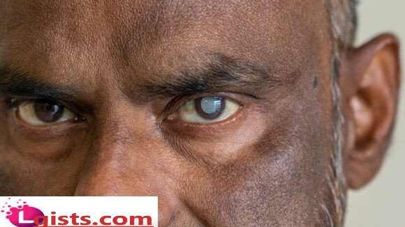 what is a cataract? Know your symptoms and causes