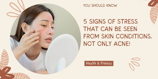 5 Signs of Stress That Can Be Seen from Skin Conditions, Not Only Acne!