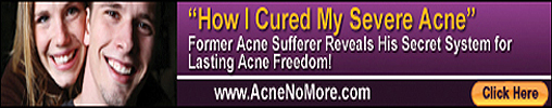 Acne Treatment Review