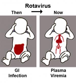 rotavirus  pictures