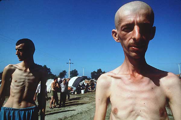 Bosniak Civilians in Trnopolje Concentration Camp in 1992 Bosnian Genocide