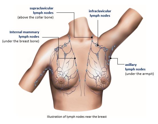 WHAT IS BREAST CANCER? WHAT ARE MAIN 7 WARNING SIGNS OF BREAST CANCER? CAN BREAST CANCER KILL YOU? IS BREAST CANCER DANGEROUS FOR LIFE? TYPES,  WHAT PART OF THE BREAST CANCER USUALLY FOUND? CAUSES, , DIAGMOSIS, TREATMENT