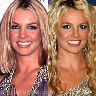 Britney Spears ANTES DA PLASTICA