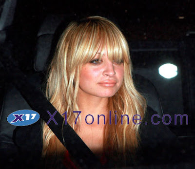 nicole richie nose job before and after. Nicole Richie Nose Job Before And After. Nicole Richie was briefly; Nicole Richie was briefly. swinneyn. Oct 27, 07:04 PM