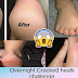 Get Rid From Cracked Heals OVERNIGHT 100% work